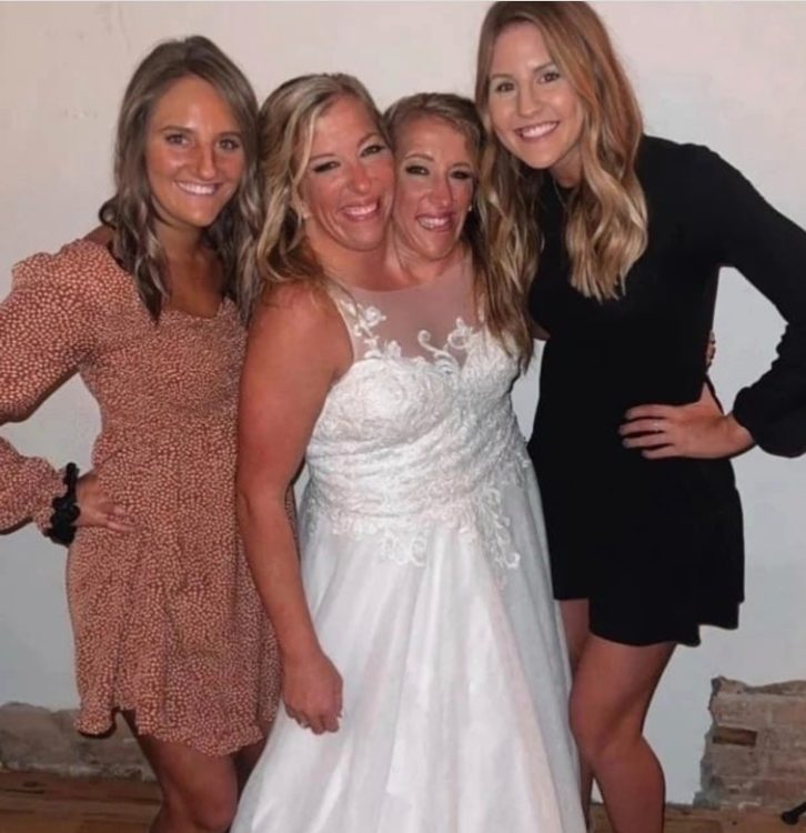 "Un marito per due sorelle": queste gemelle siamesi svelano le foto del loro matrimonio