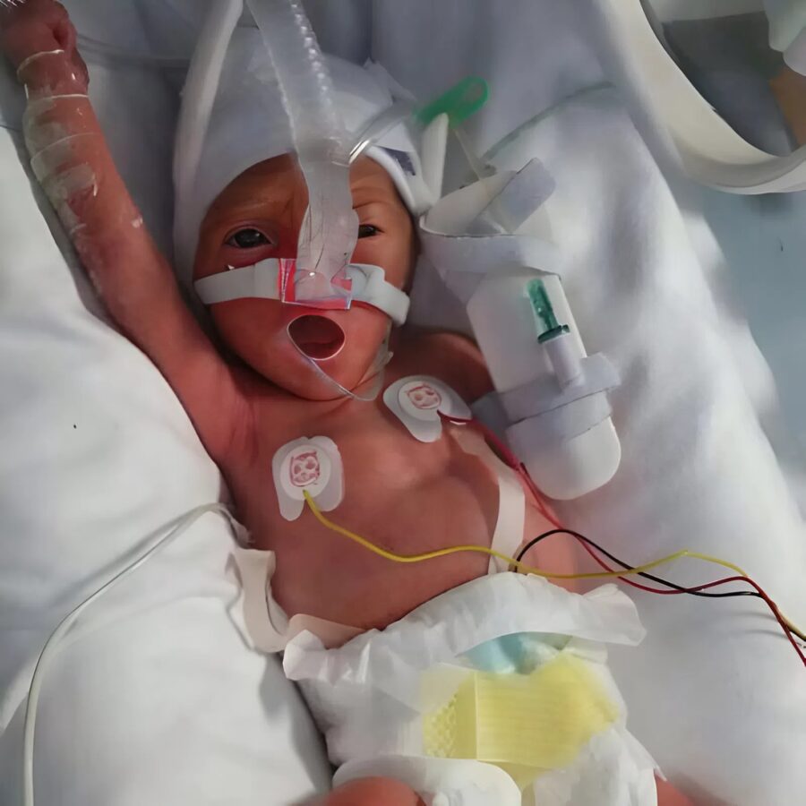 Mindenki megdermedt a kórházi szobában: senki sem értette, miért nehezedik úgy a csend, amíg végül rá nem jöttek a felfoghatatlanra